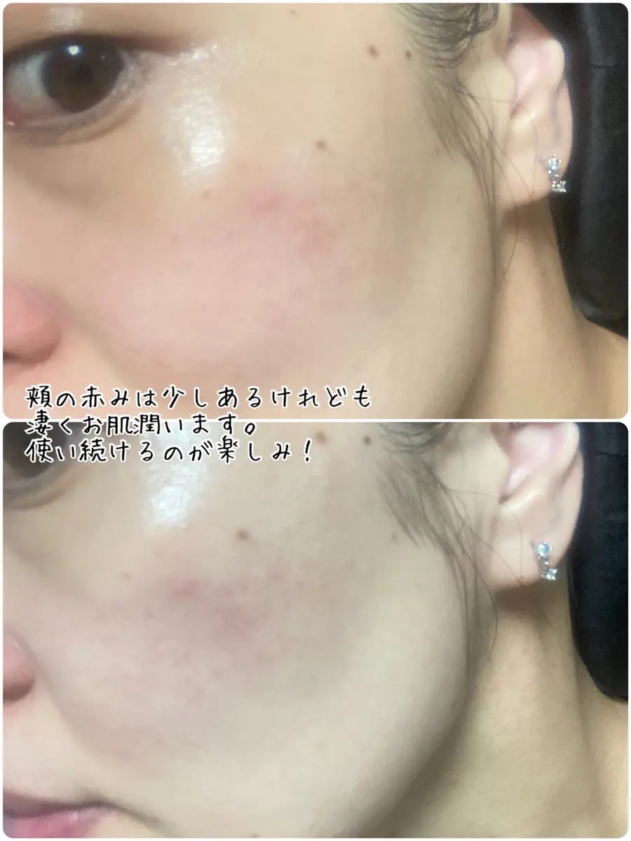 スピテラスキンフローエッセンス/NUDIQUE/美容液を使ったクチコミ（3枚目）