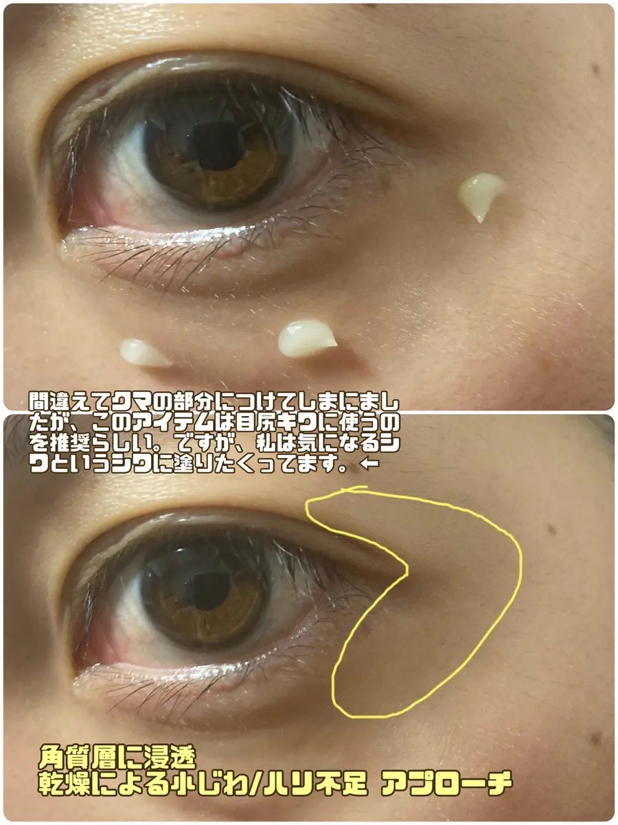 レチノールアイファルトアイバッククリーム/Dr.Melaxin/アイケア・アイクリームを使ったクチコミ（2枚目）