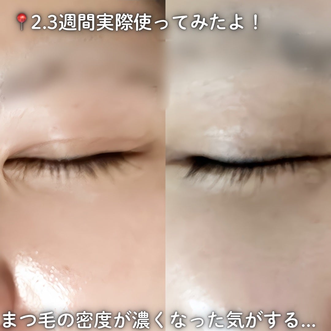 アイラッシュエッセンシャルセラム/epais/まつげ美容液を使ったクチコミ(3枚目)