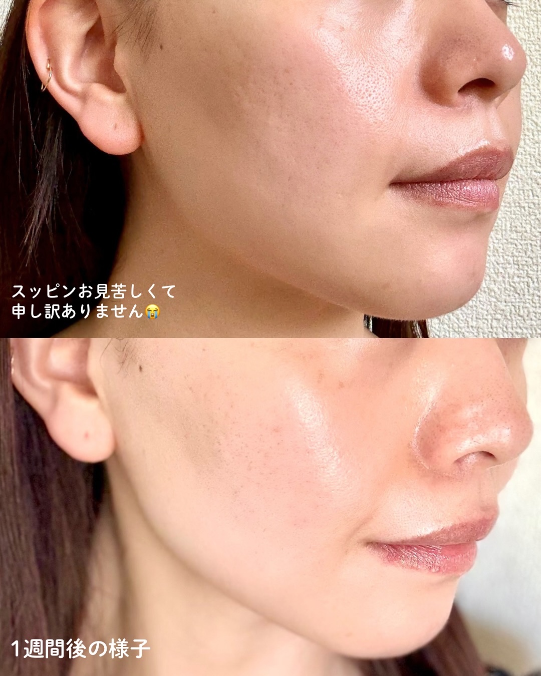 PDRNカフェインショット/IOPE/美容液を使ったクチコミ（2枚目）