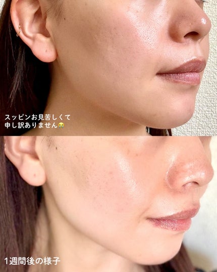 PDRNカフェインショット/IOPE/美容液を使ったクチコミ(2枚目)