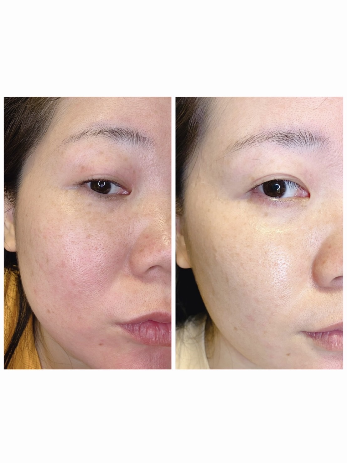 リアルコラーゲンフィット/TOSOWOONG/フェイスクリームを使ったクチコミ（3枚目）