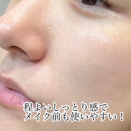 ReDRNエクソソームアンプル/Dr.nineteen/美容液を使ったクチコミ(5枚目)