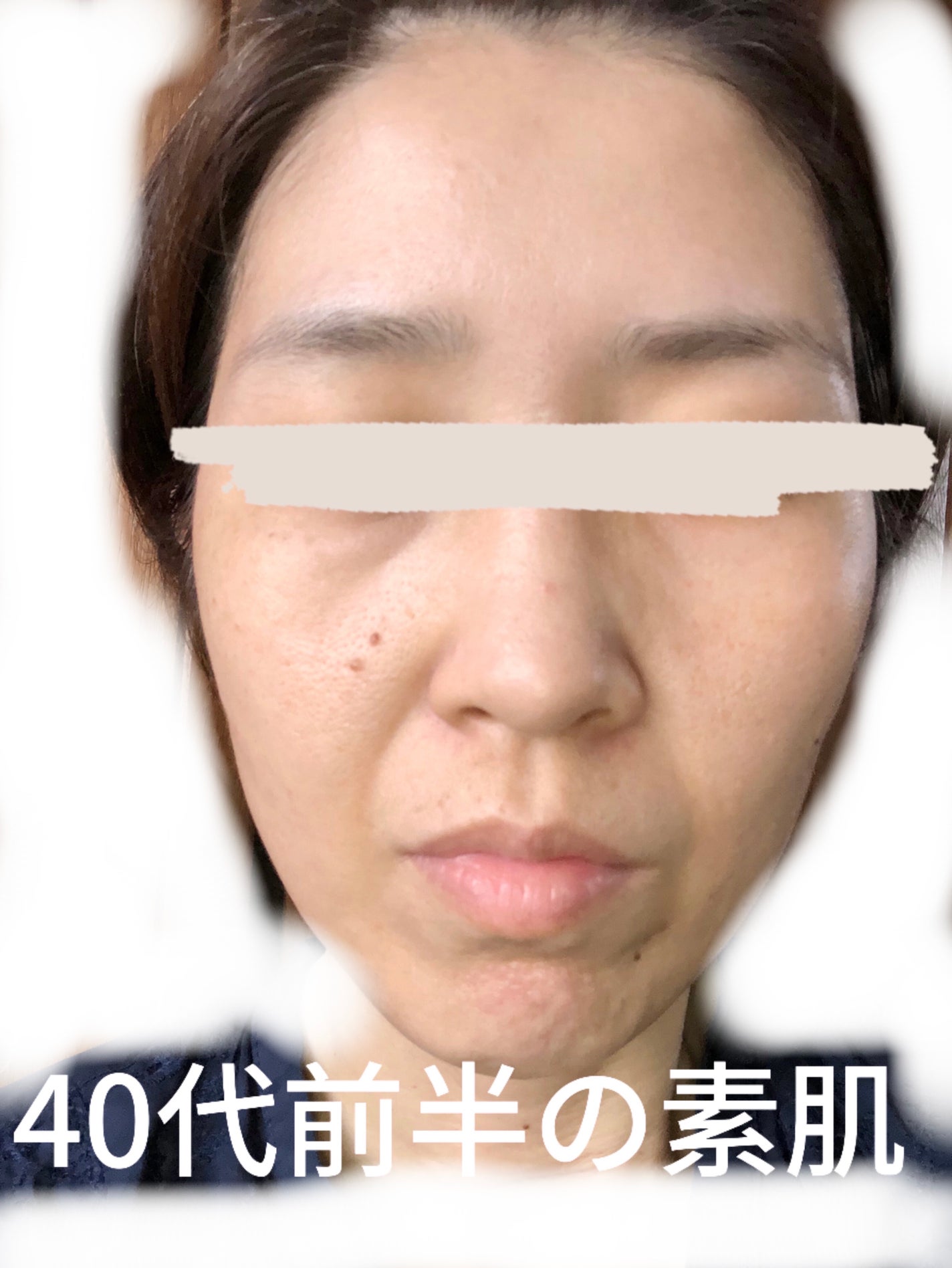 AZELAIC ACID プレミアムケアマスク/MDSKIN LABO/シートマスク・パックを使ったクチコミ(1枚目)