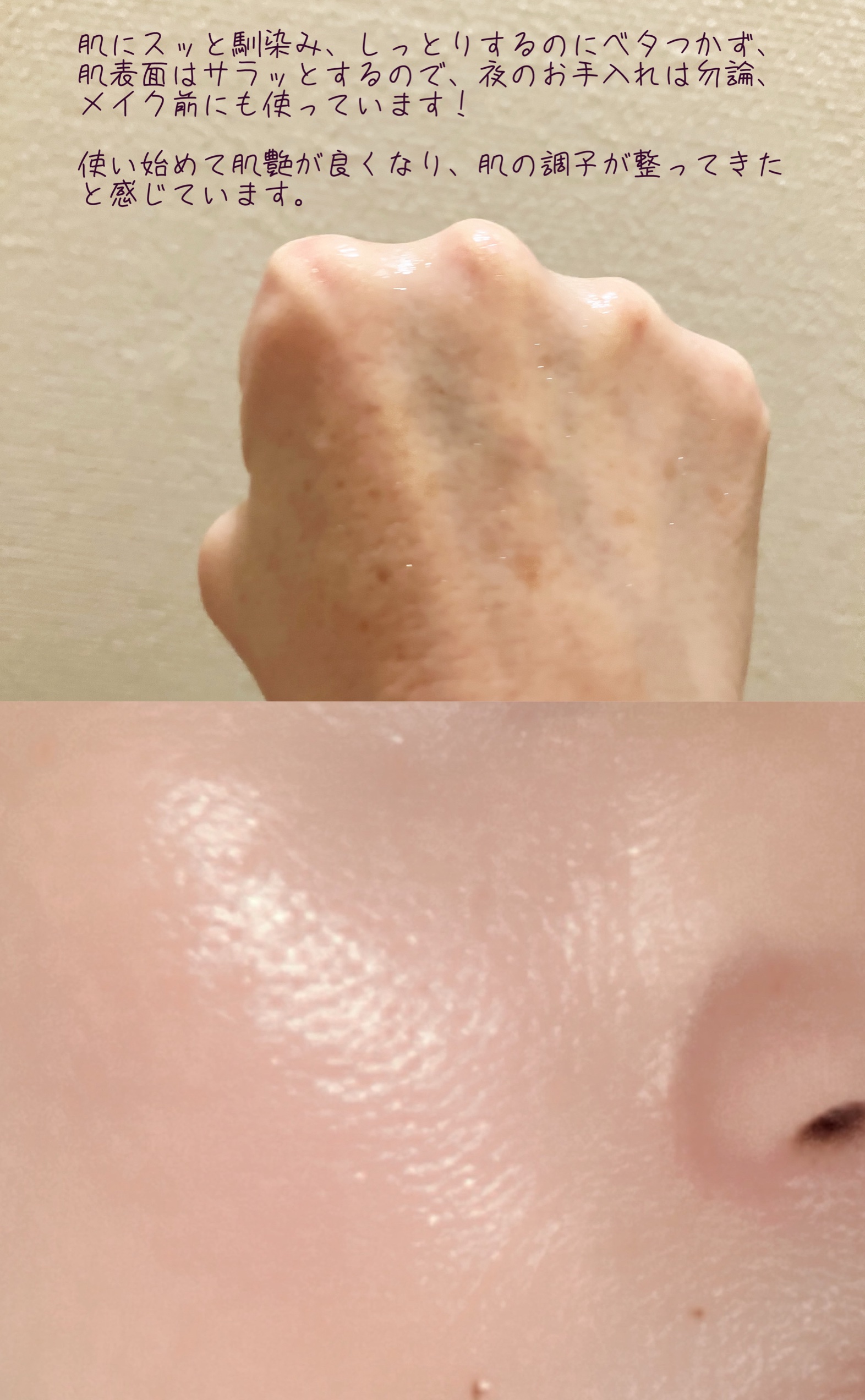 G3ナイアシンセラム/urbanand/美容液を使ったクチコミ（3枚目）