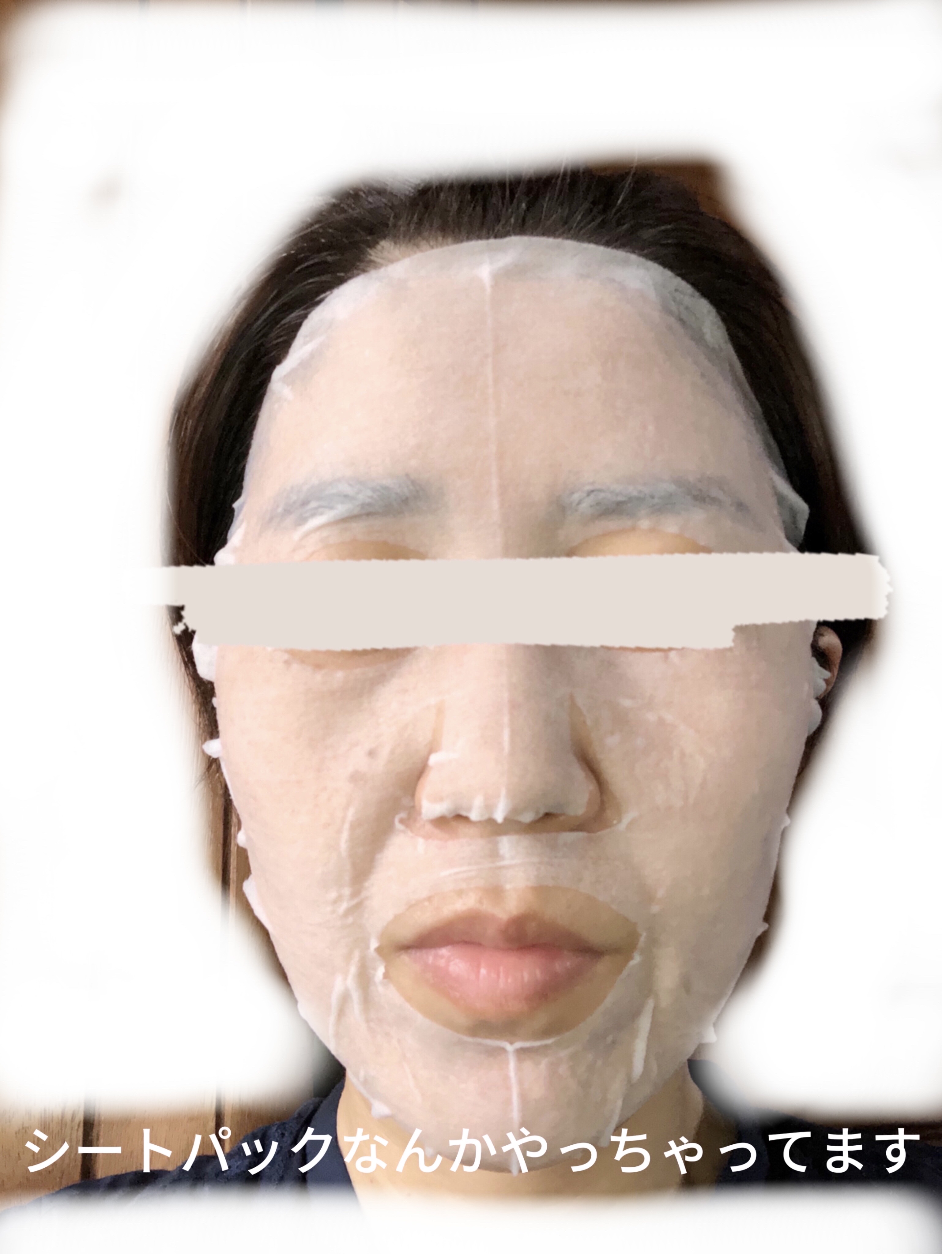 AZELAIC ACID プレミアムケアマスク/MDSKIN LABO/シートマスク・パックを使ったクチコミ（2枚目）