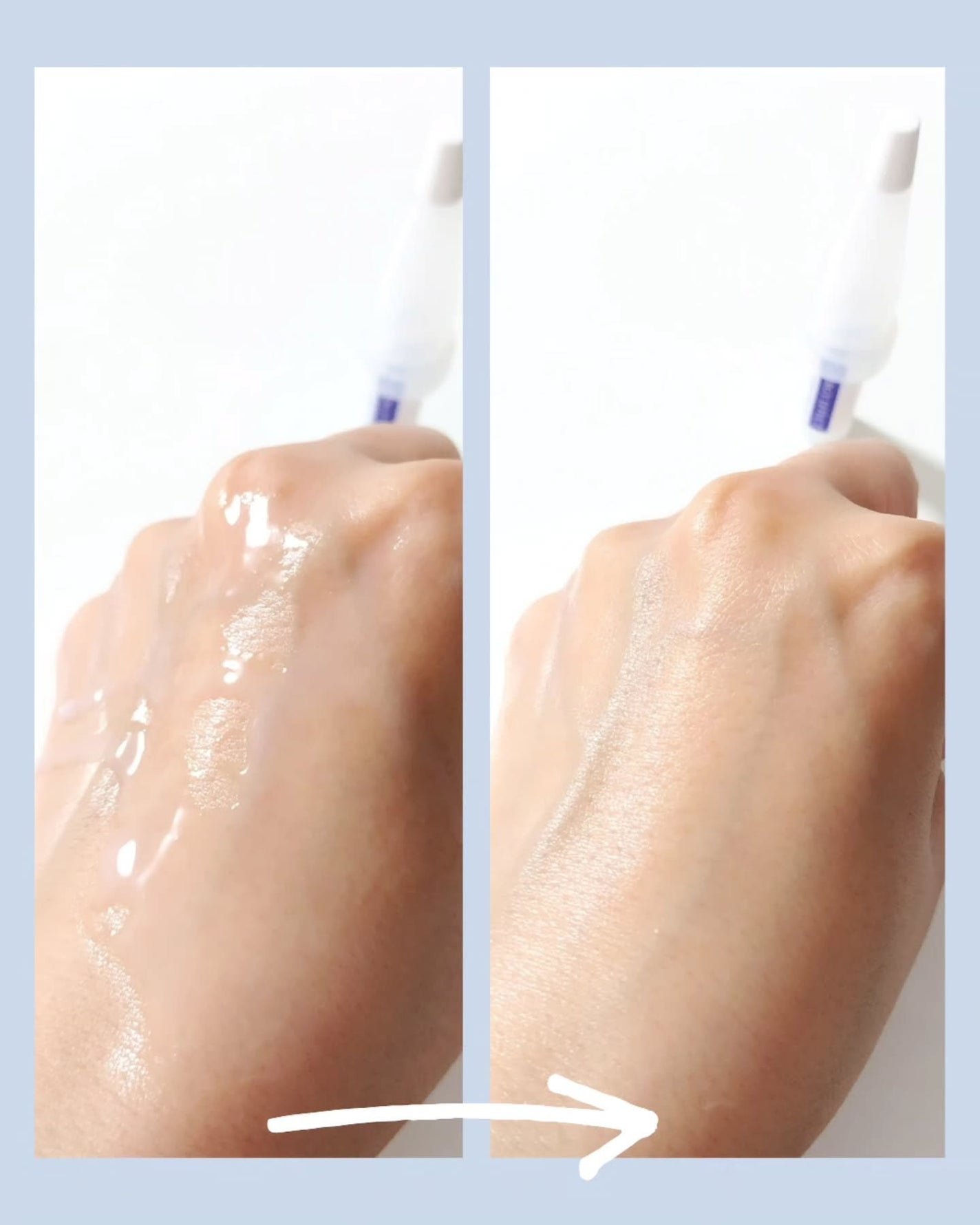 BTXクリームアンプル/MAXCLINIC/フェイスクリームを使ったクチコミ(6枚目)