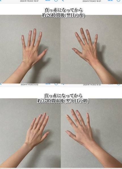 4番 ひんやりクーリングシートマスク/numbuzin/シートマスク・パックを使ったクチコミ(4枚目)