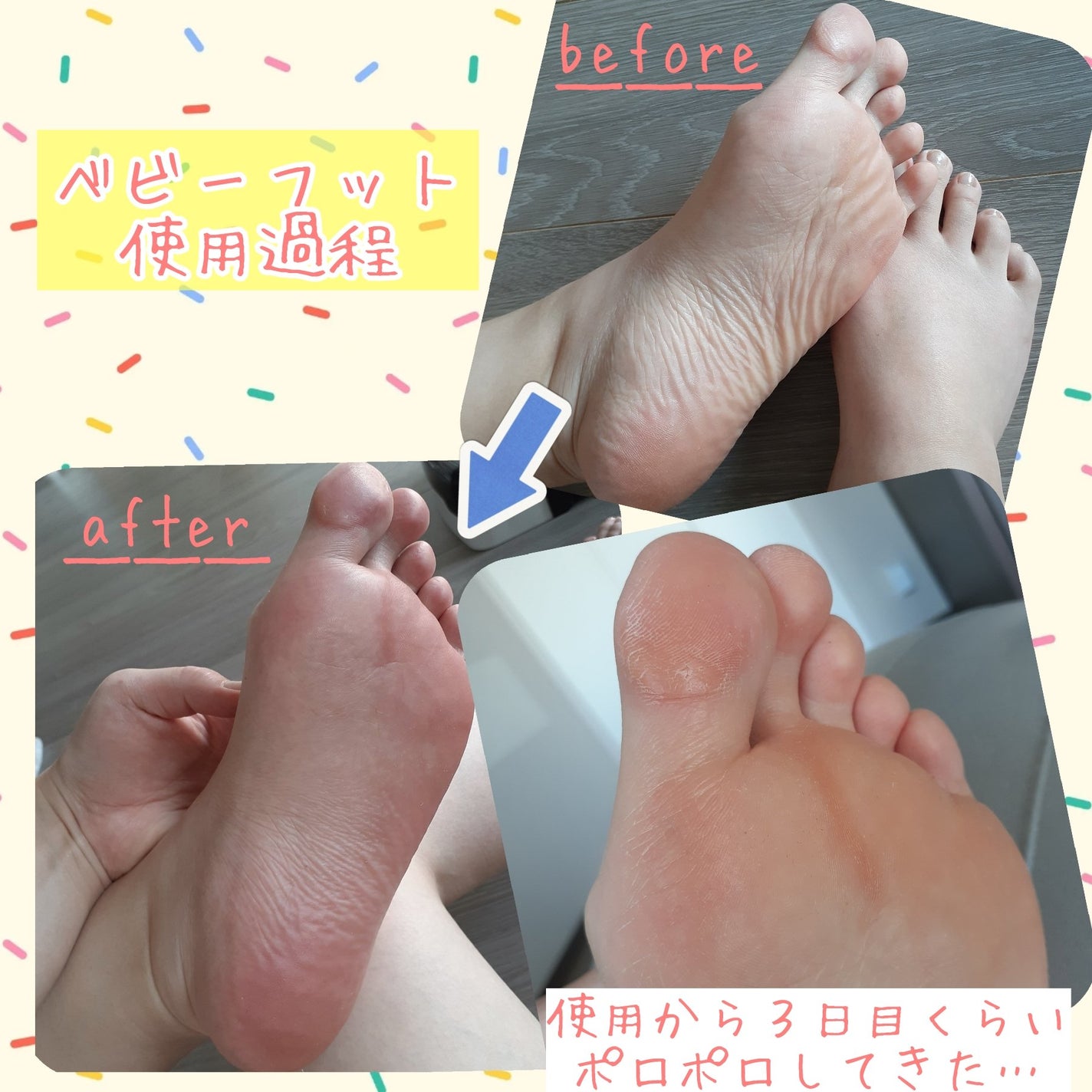 イージーパックDP60分タイプ/ベビーフット/レッグ・フットケアを使ったクチコミ(5枚目)