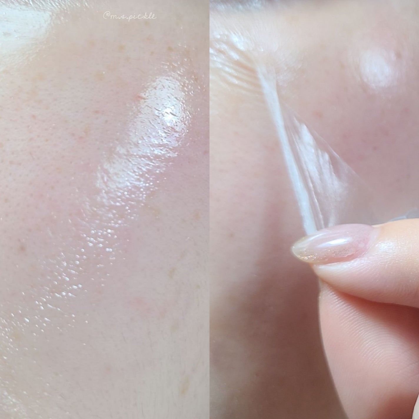 ローズコラーゲン グローマルチバーム/MIGUHARA/フェイスバームを使ったクチコミ(6枚目)