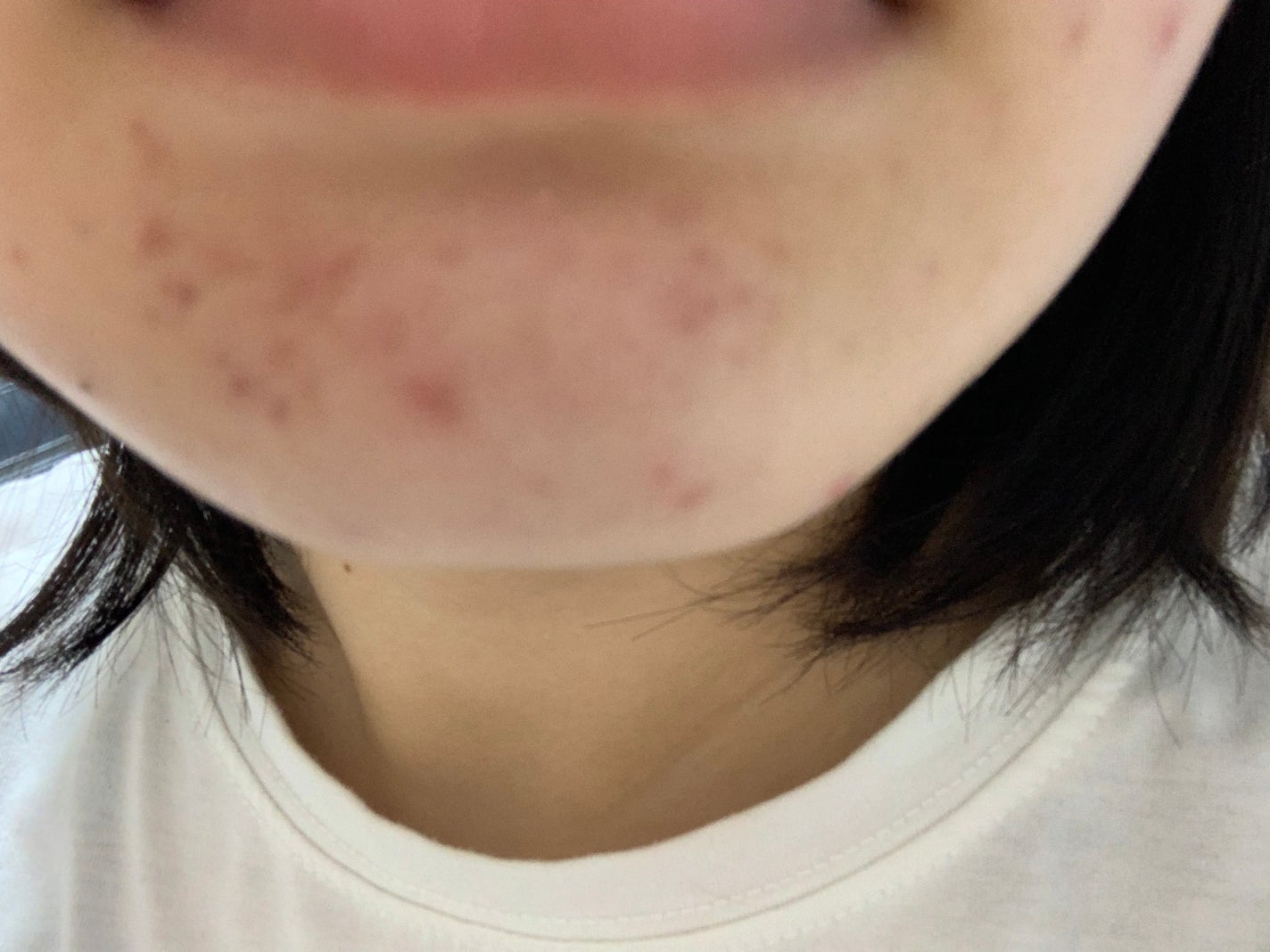 さく on LIPS 「今日のお肌✨投稿少なくなっちゃってすみません、スキンケア変えて..」(4枚目)