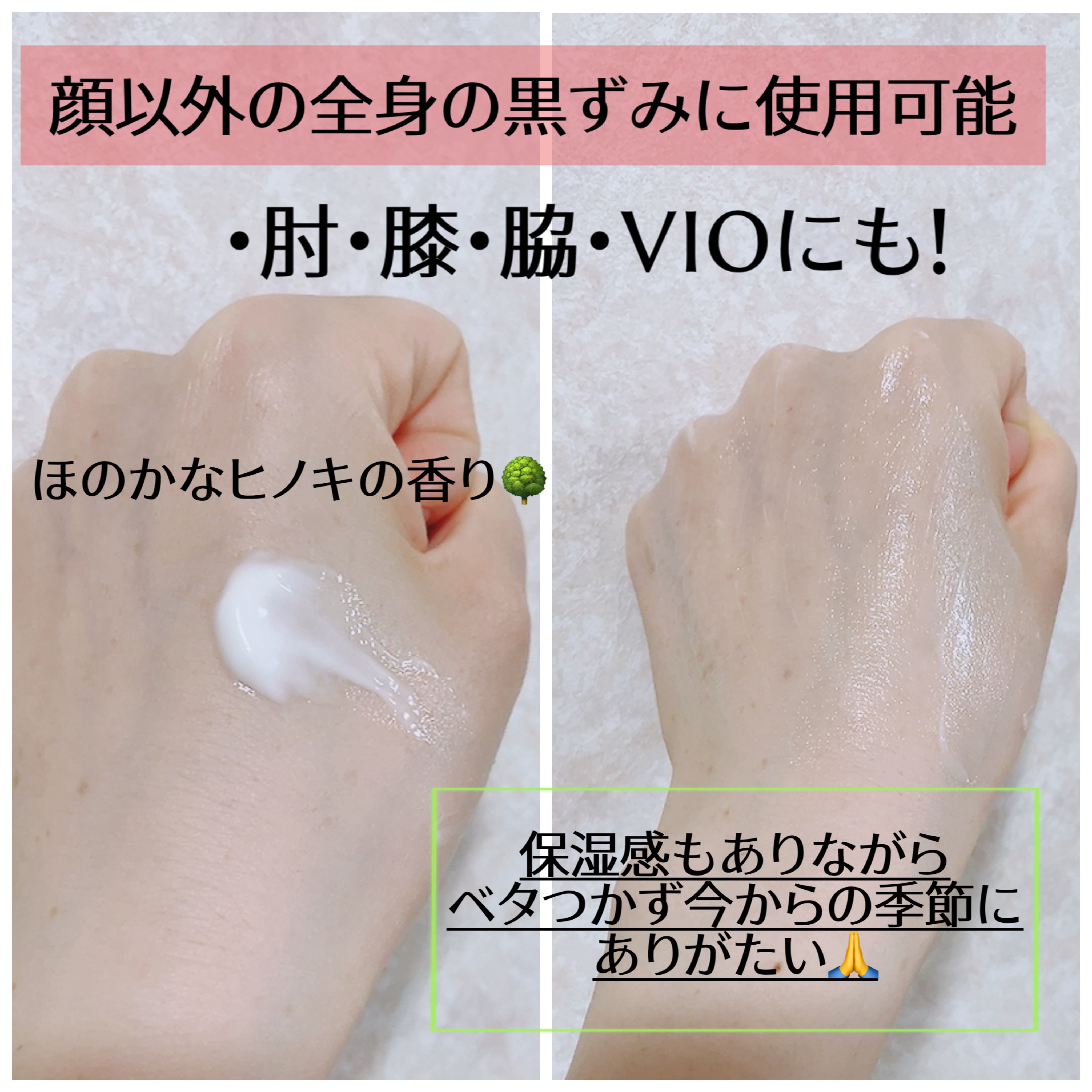 BnDアンダーアームクリーム(ボディクリーム)/BnD/デリケートゾーンケアを使ったクチコミ（3枚目）