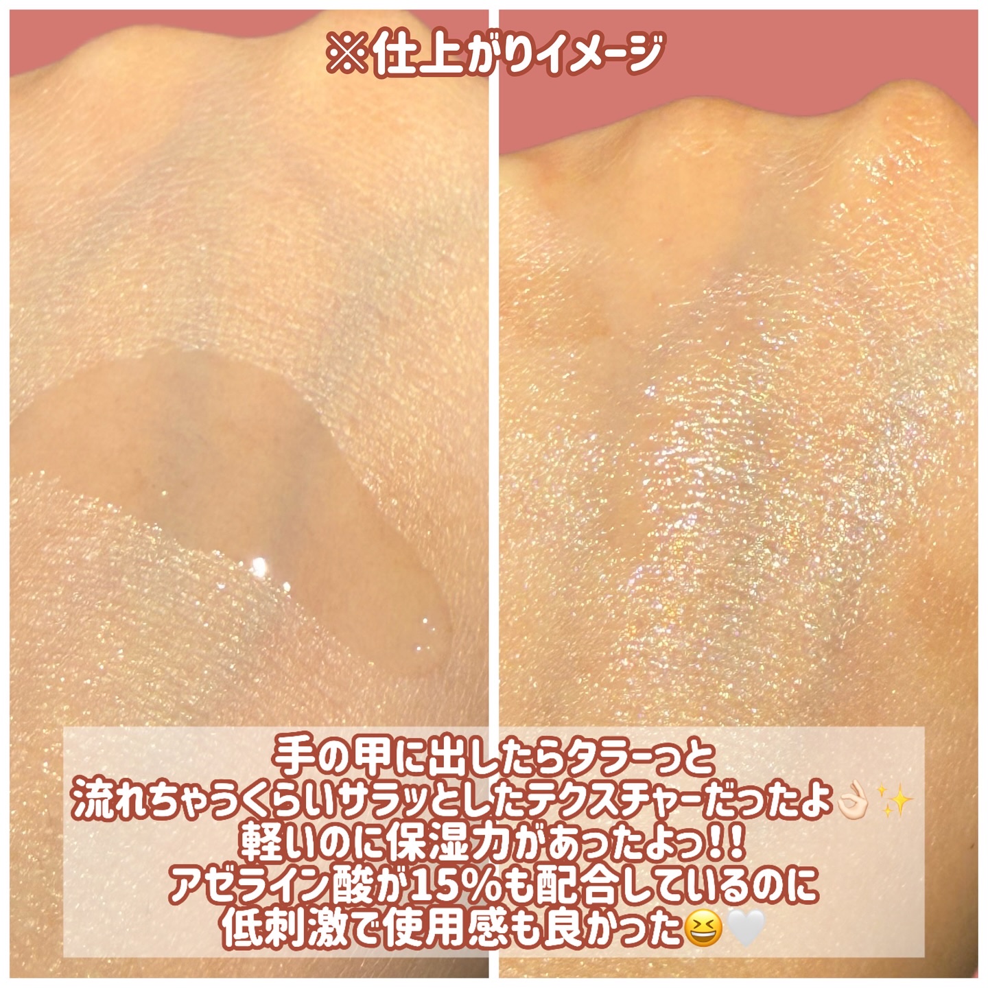 AZアゼライン酸15セラム/コスデバハ/美容液を使ったクチコミ（3枚目）