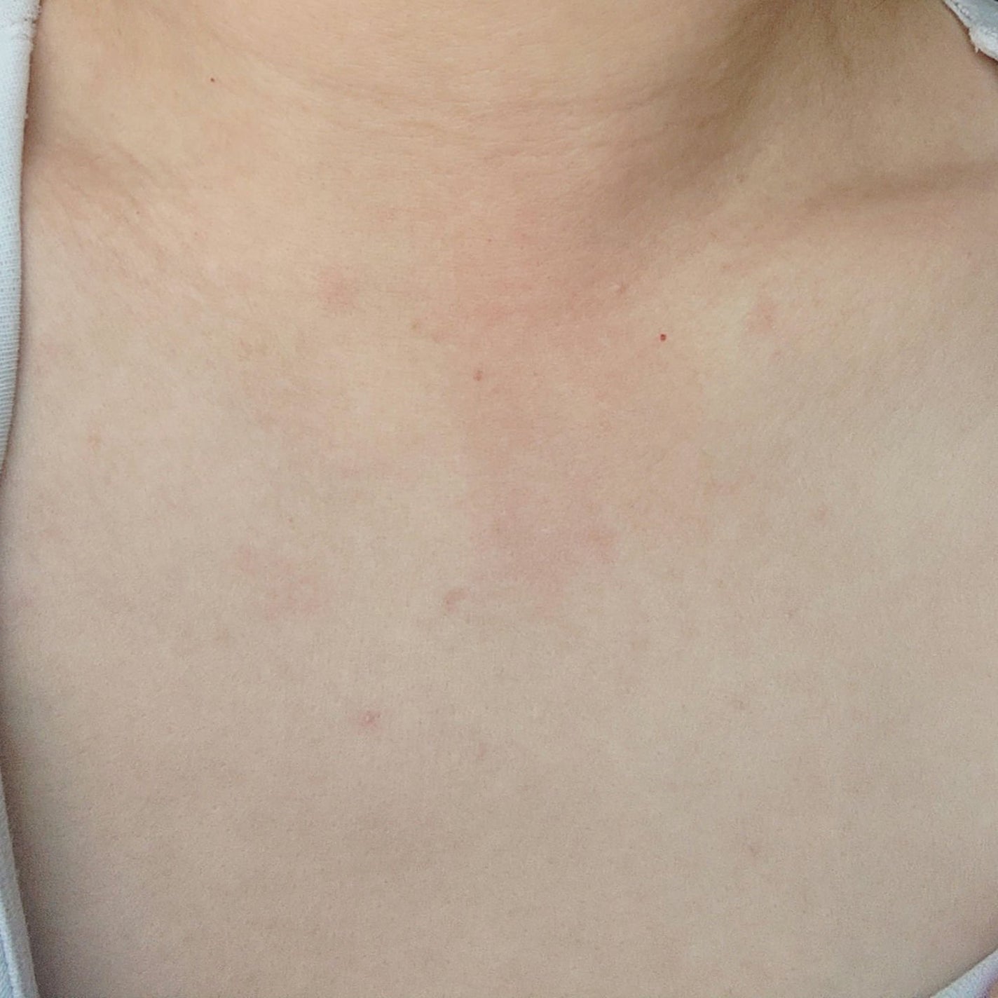 REJURAN リバランシングトナー 120ml /REJURAN COSMETICS/化粧水を使ったクチコミ(3枚目)