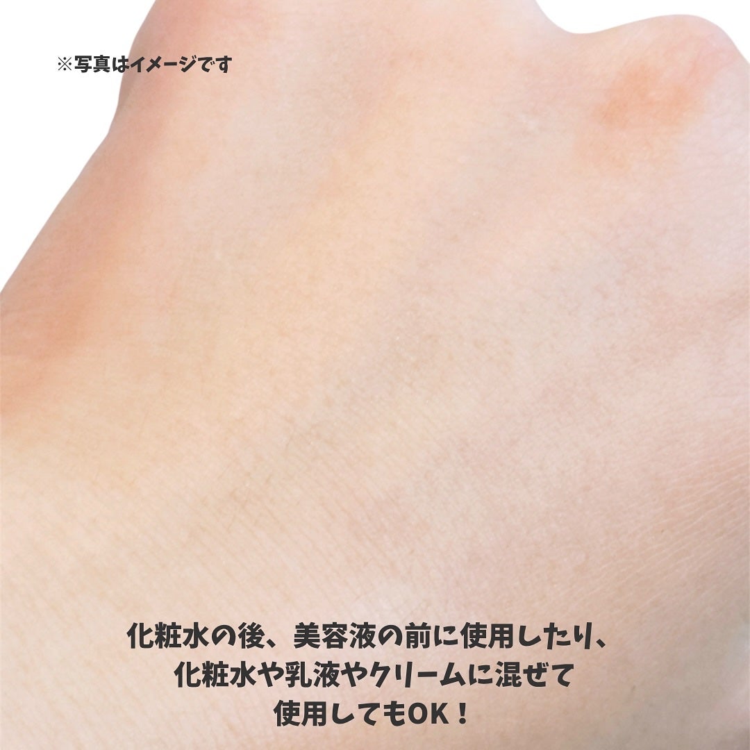 えび松(春br) on LIPS 「\アゼライン酸の『原液』爆誕/美容の情報など発信中▶▶▶@e..」(4枚目)