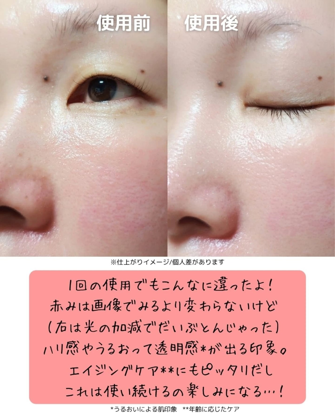 レッドモチセラム30/アレンシア/美容液を使ったクチコミ(5枚目)