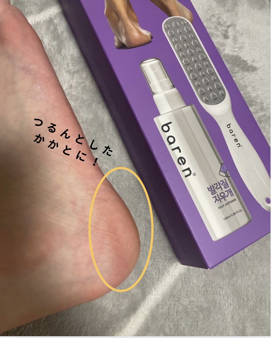 フットケアセット/BAREN/その他キットセットを使ったクチコミ（3枚目）