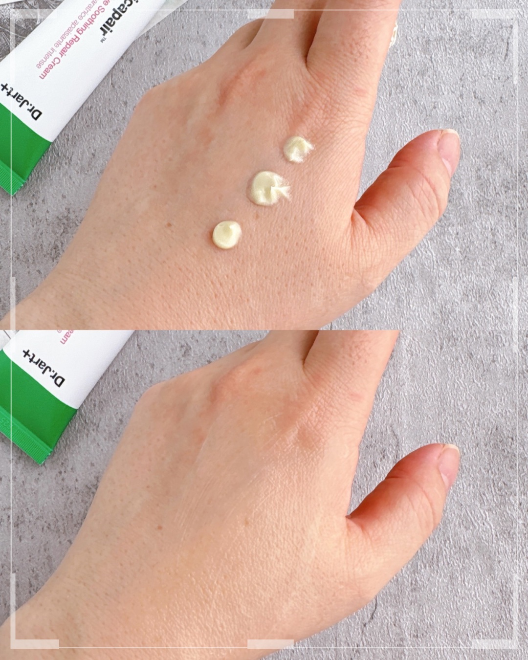 ドクタージャルト シカペア クリーム （第2世代）/Dr.Jart＋/フェイスクリームを使ったクチコミ（3枚目）