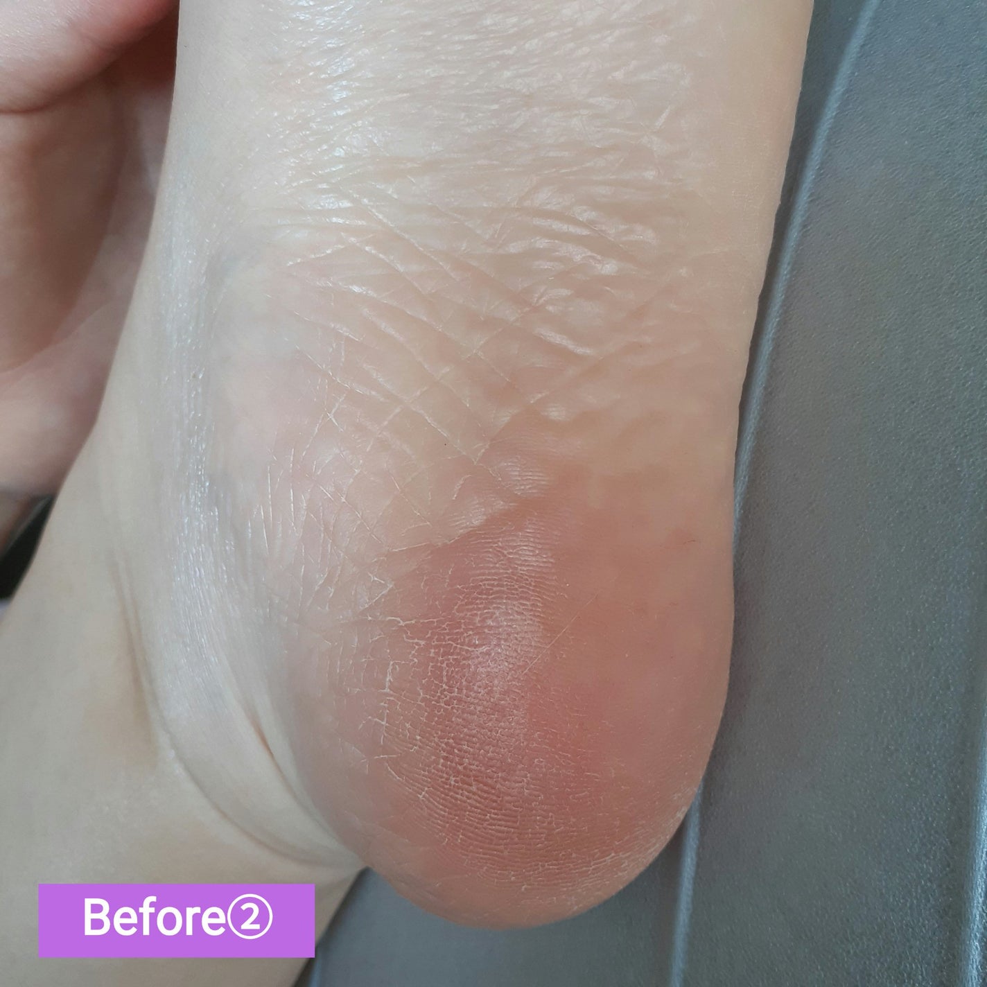 イージーパックDP60分タイプ/ベビーフット/レッグ・フットケアを使ったクチコミ(7枚目)