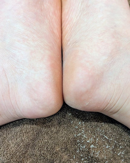 フットケアセット/BAREN/その他キットセットを使ったクチコミ(5枚目)