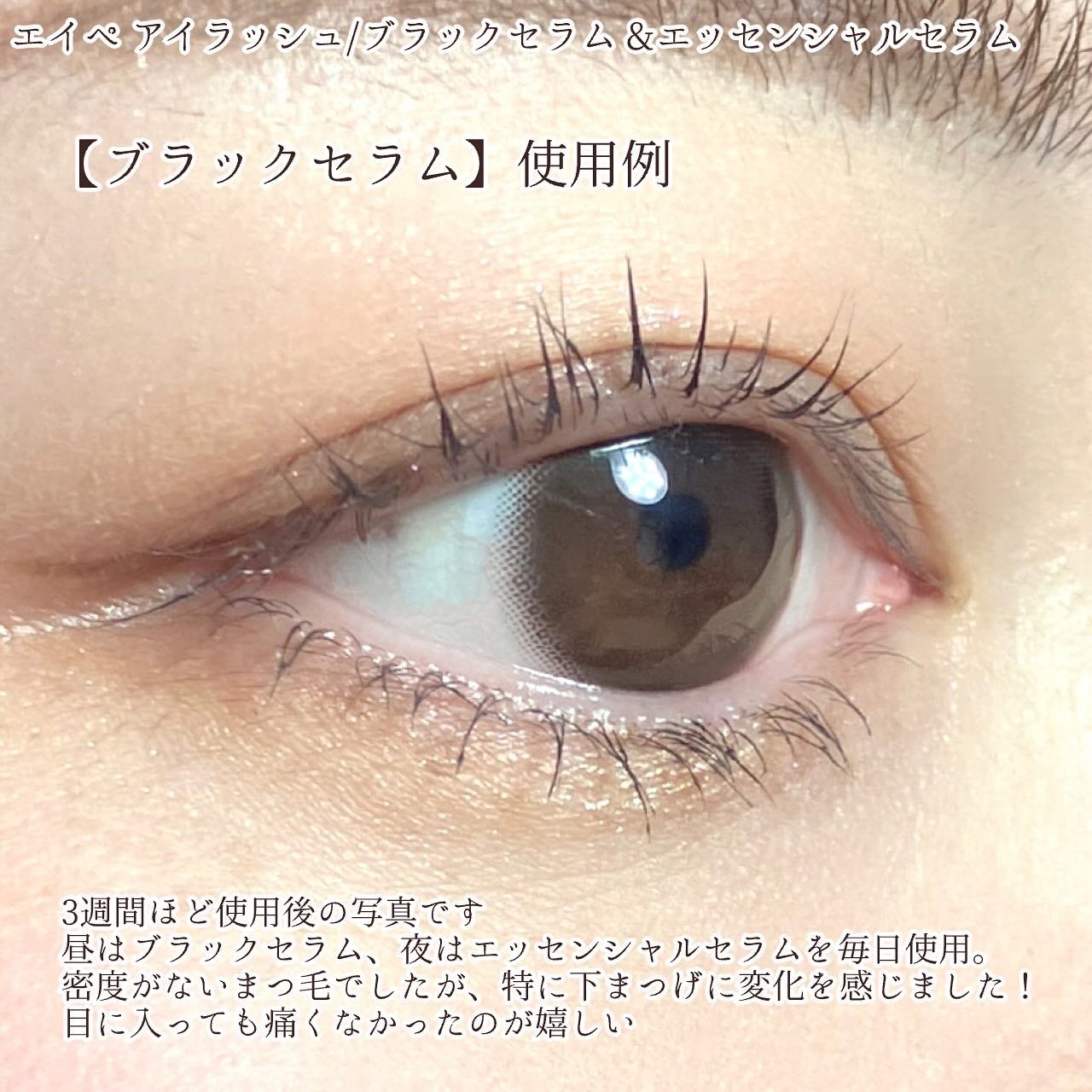 アイラッシュエッセンシャルセラム/epais/まつげ美容液を使ったクチコミ(3枚目)
