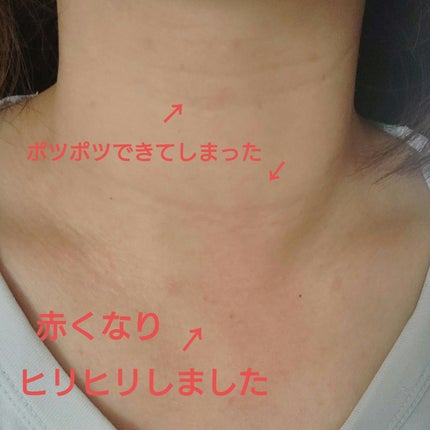 REJURAN リバランシングトナー 120ml /REJURAN COSMETICS/化粧水を使ったクチコミ(4枚目)