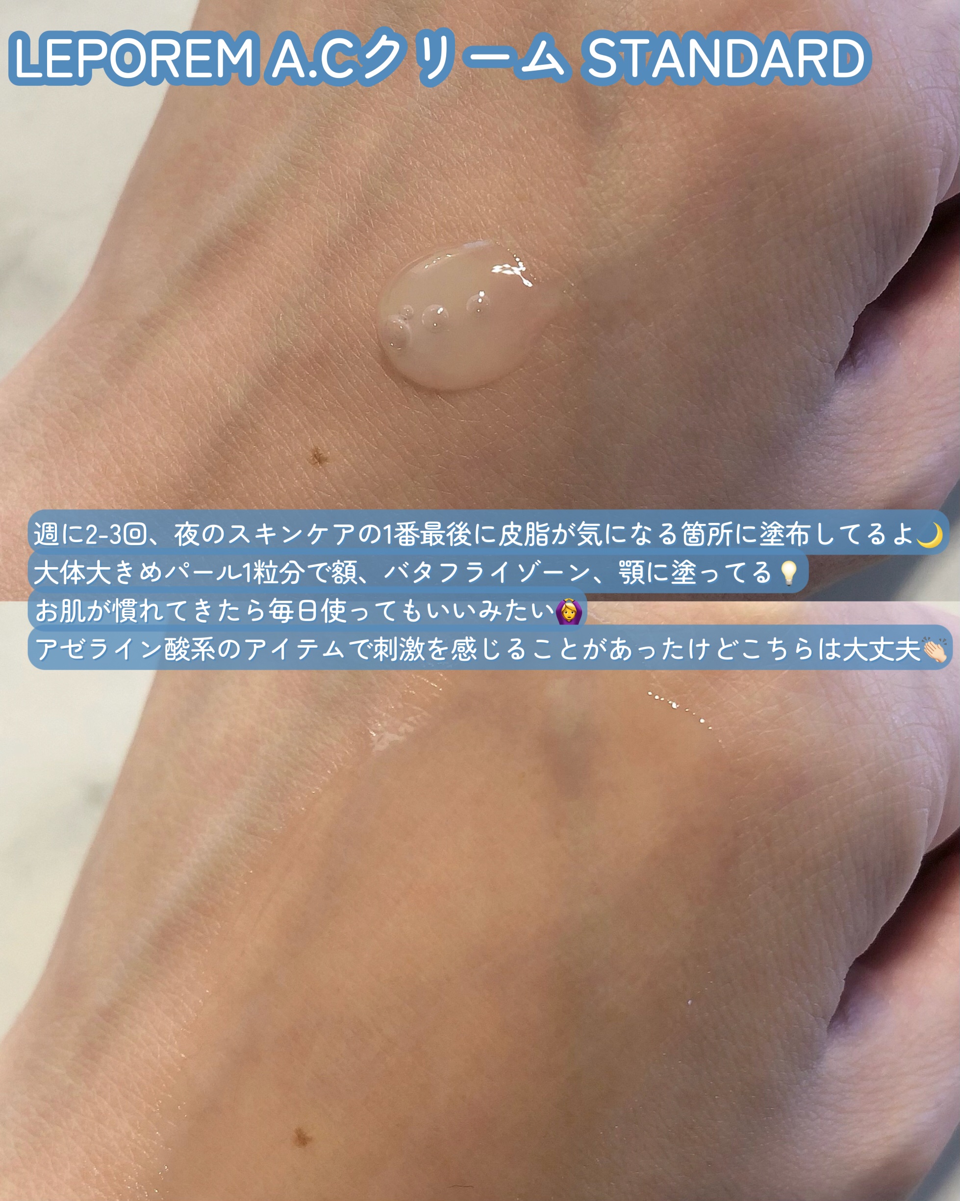 ACクリーム/LEPOREM/フェイスクリームを使ったクチコミ（3枚目）