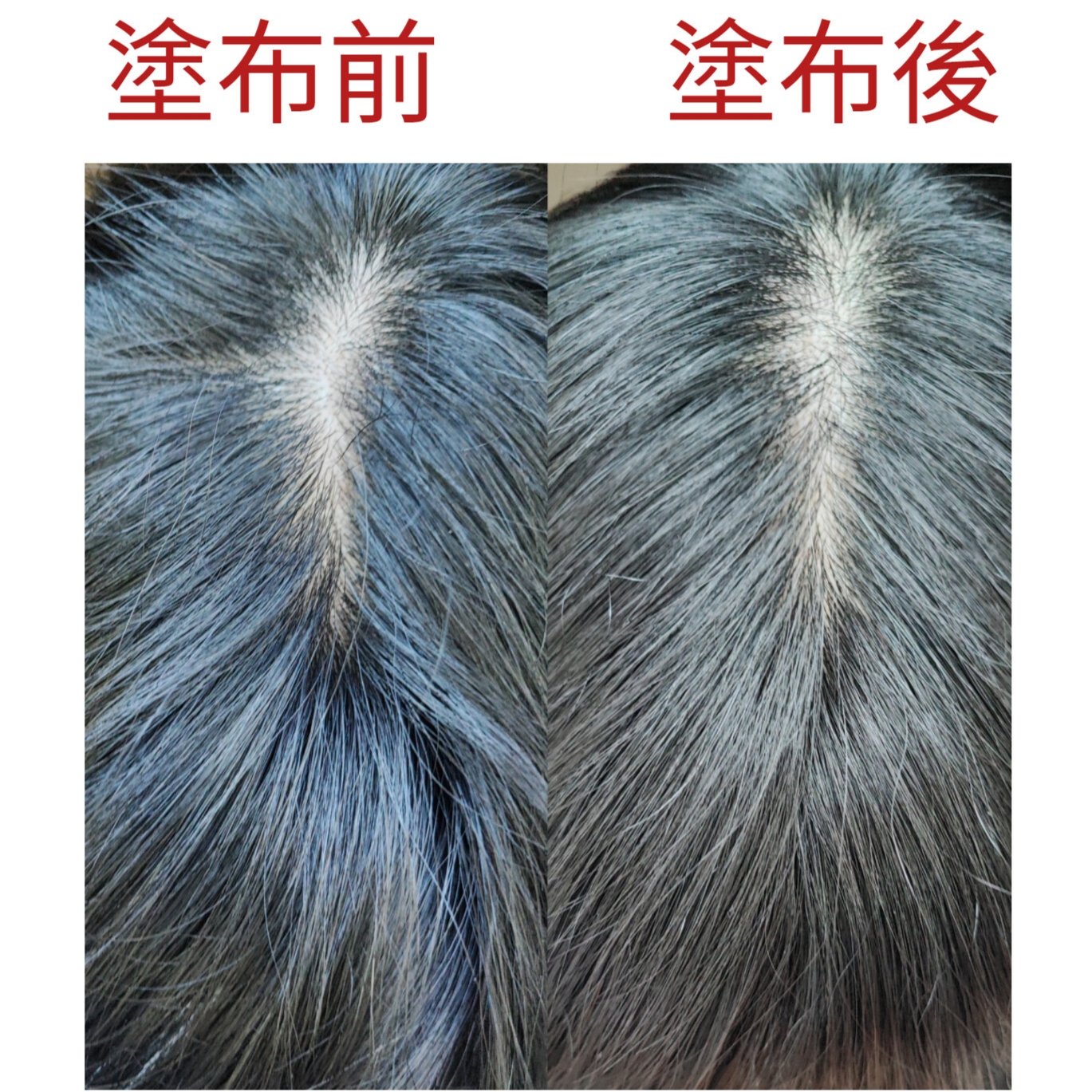 ダブルバランシングトナー/woodiv/頭皮ローションを使ったクチコミ（2枚目）