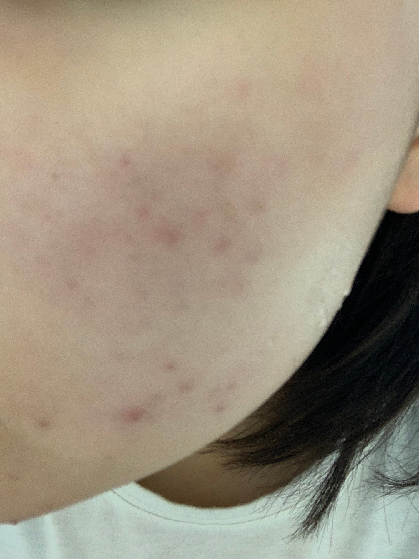 さく on LIPS 「今日のお肌✨投稿少なくなっちゃってすみません、スキンケア変えて..」(2枚目)