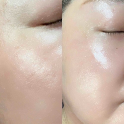 ビタ5X コラーゲン クリーム ミスト/D'amu/ミスト状化粧水を使ったクチコミ（3枚目）