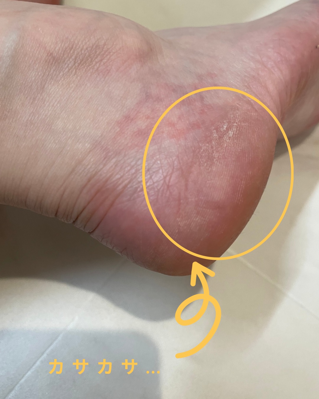 フットケアセット/BAREN/その他キットセットを使ったクチコミ（2枚目）