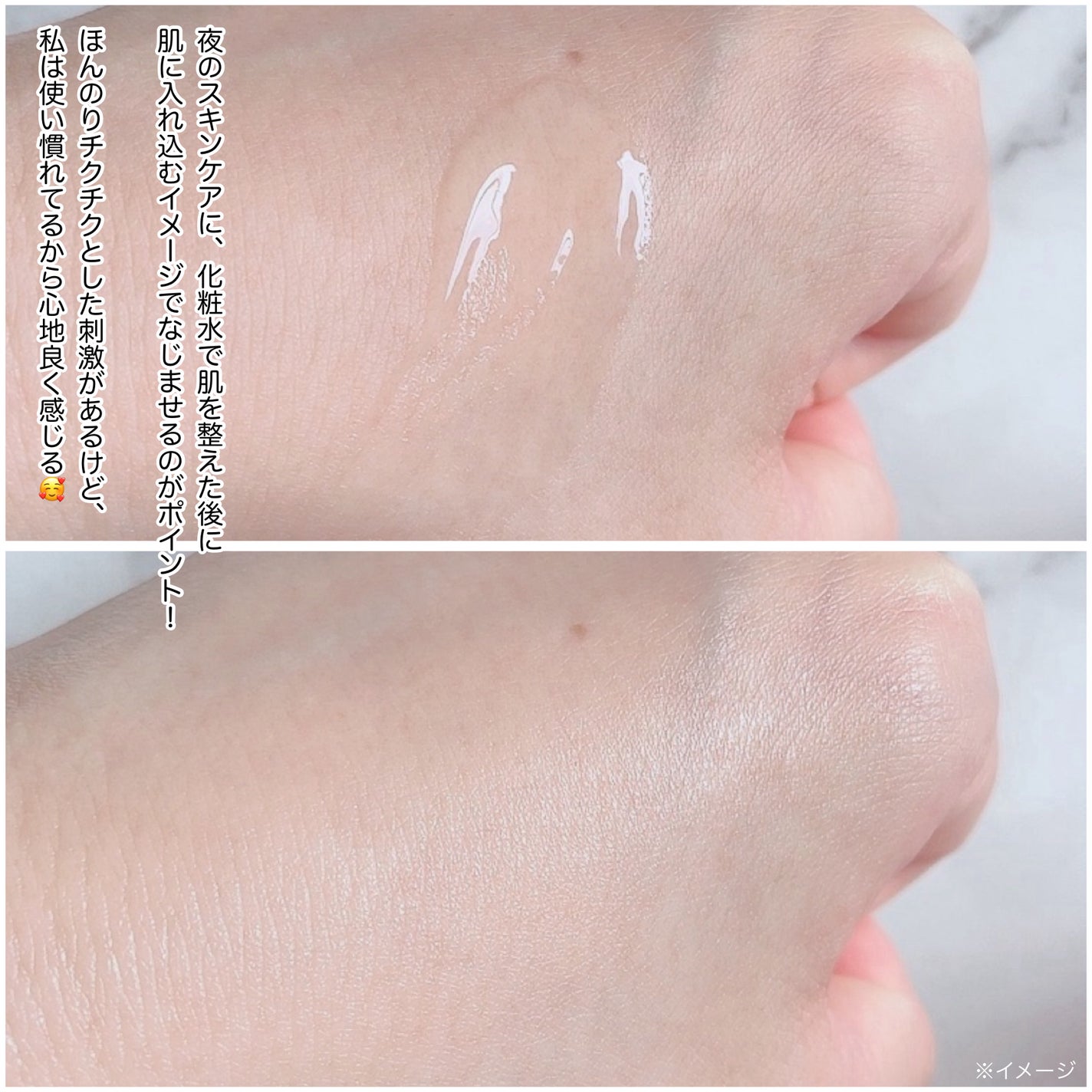 ナイトリペアニードルショット/HARILOGY/美容液を使ったクチコミ(7枚目)