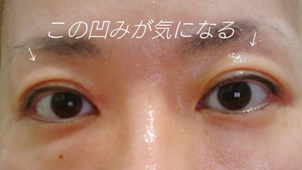 デュアル エフェクト アンプル/REJURAN COSMETICS/美容液を使ったクチコミ(3枚目)