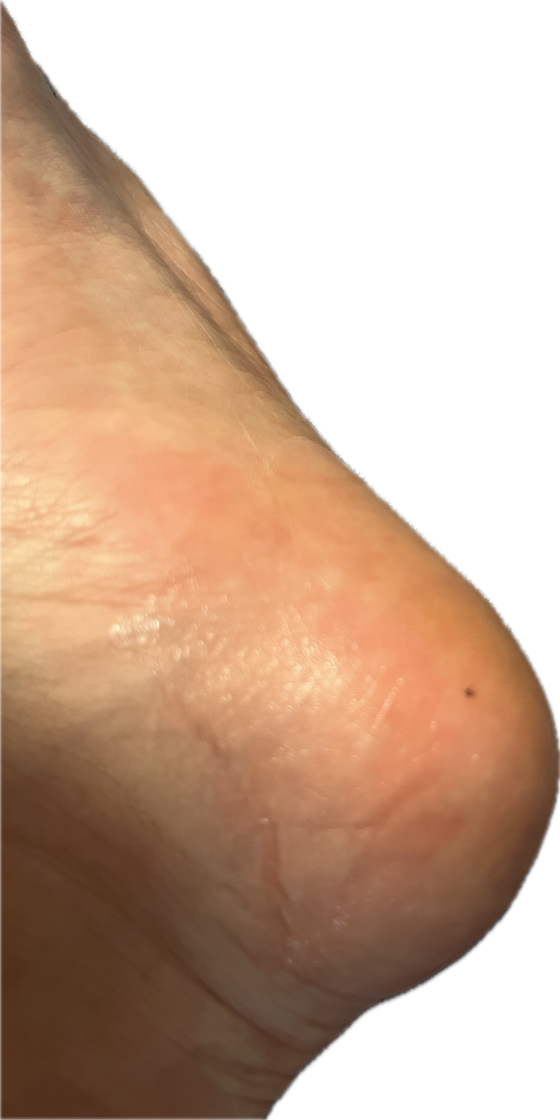 シアバター スリーピング ヒール パッチ/BAREN/レッグ・フットケアを使ったクチコミ（3枚目）