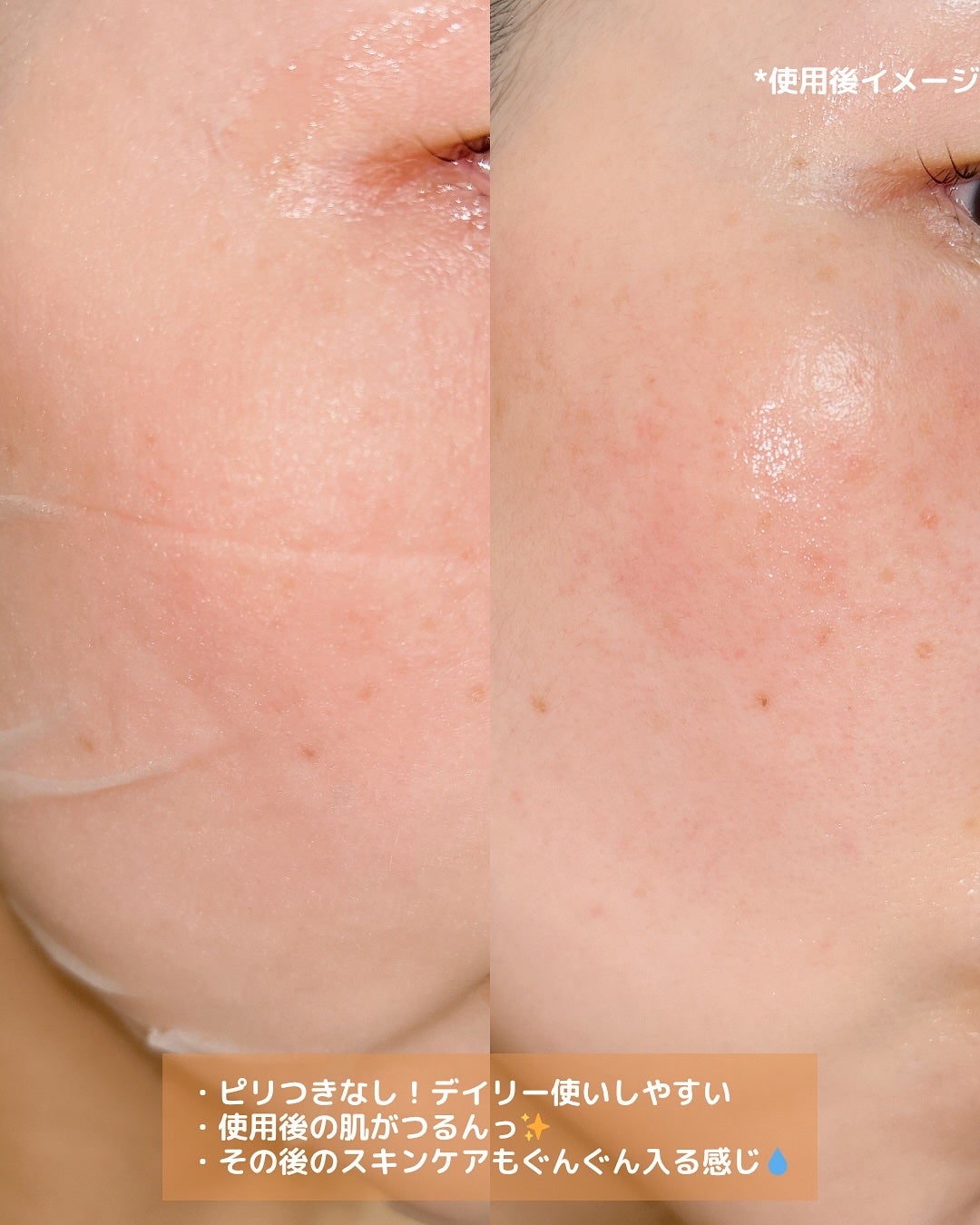 レチララ デイリーシートマスク/ネイチャーリパブリック/シートマスク・パックを使ったクチコミ(3枚目)