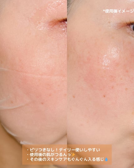 レチララ デイリーシートマスク/ネイチャーリパブリック/シートマスク・パックを使ったクチコミ(3枚目)