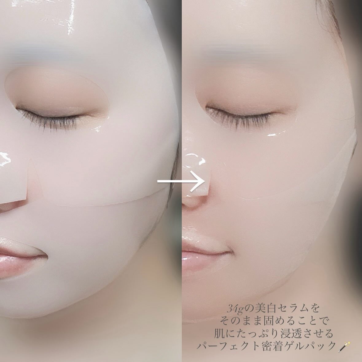 RXザ・アルファアルブチン2 ニキビ跡ケアセラム/COSRX/美容液を使ったクチコミ(4枚目)