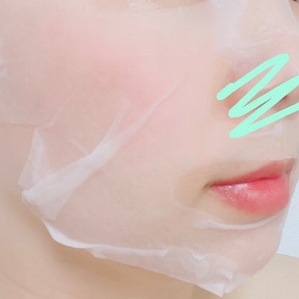 マデカッソシド ブレミッシュマスク/MEDIHEAL/シートマスク・パックを使ったクチコミ(6枚目)