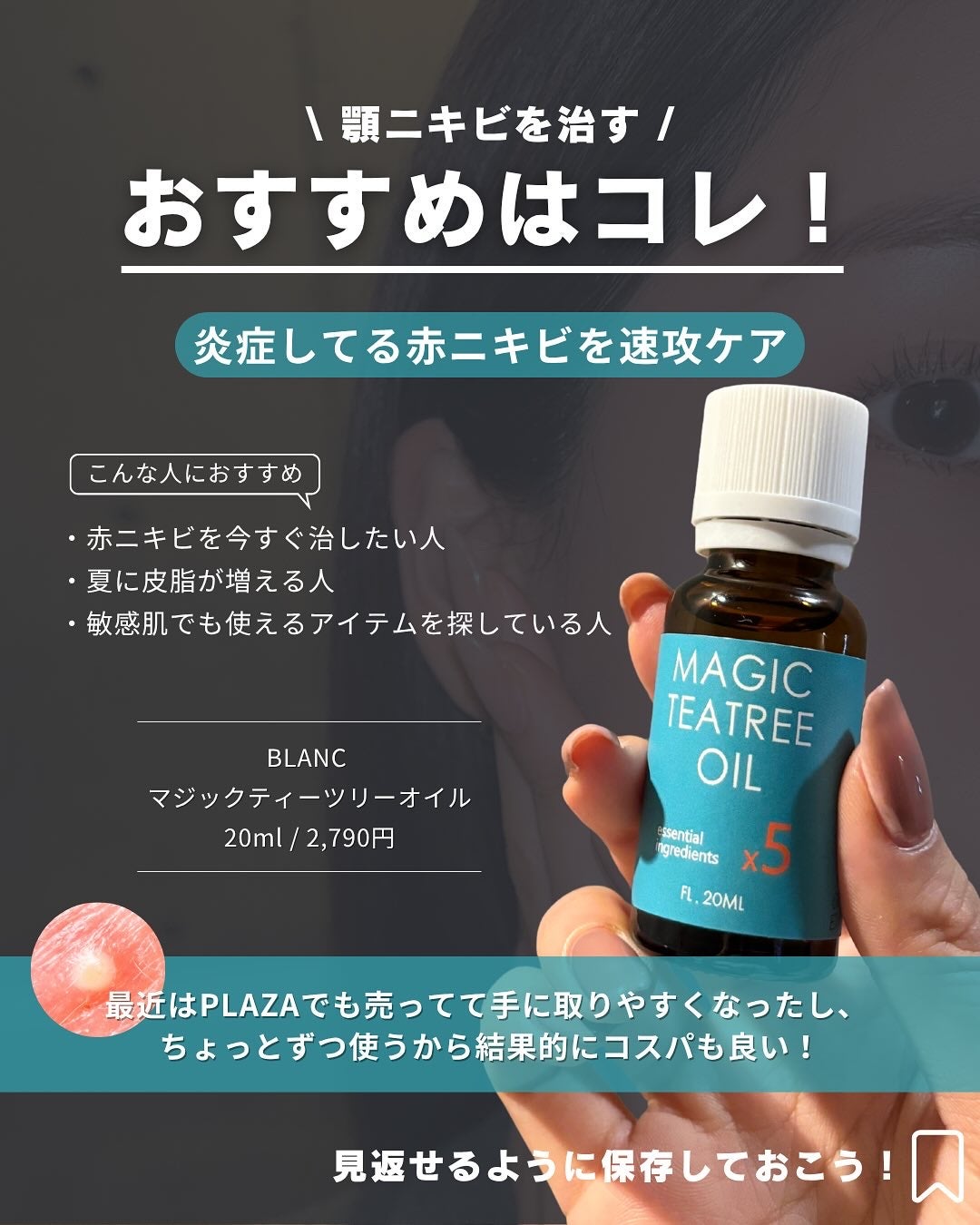 白湯(サユ) | ニキビと戦うOL🤍 on LIPS 「・白湯です🫶🏻繰り返す顎ニキビで悩んでいる人集合〜💨何しても治..」(8枚目)