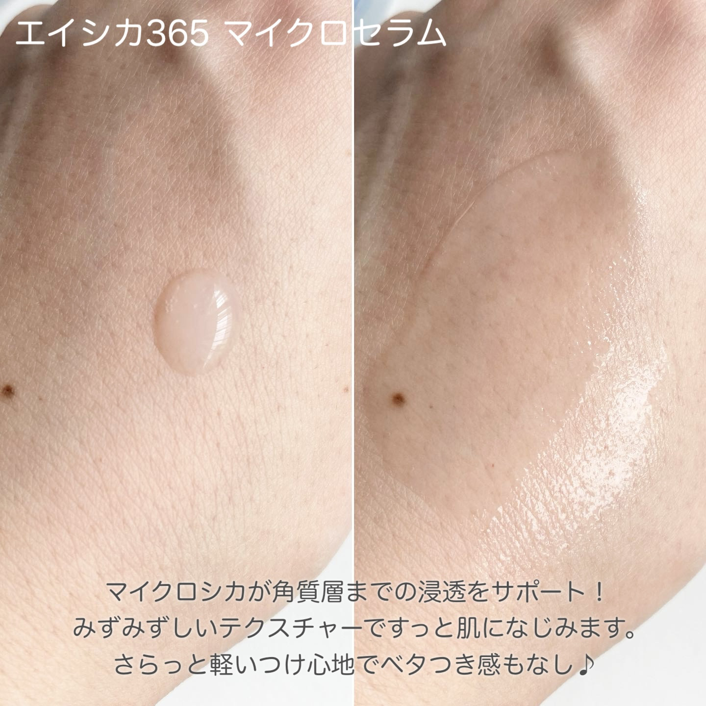 エイシカ365マイクロセラム/AESTURA/美容液を使ったクチコミ（2枚目）