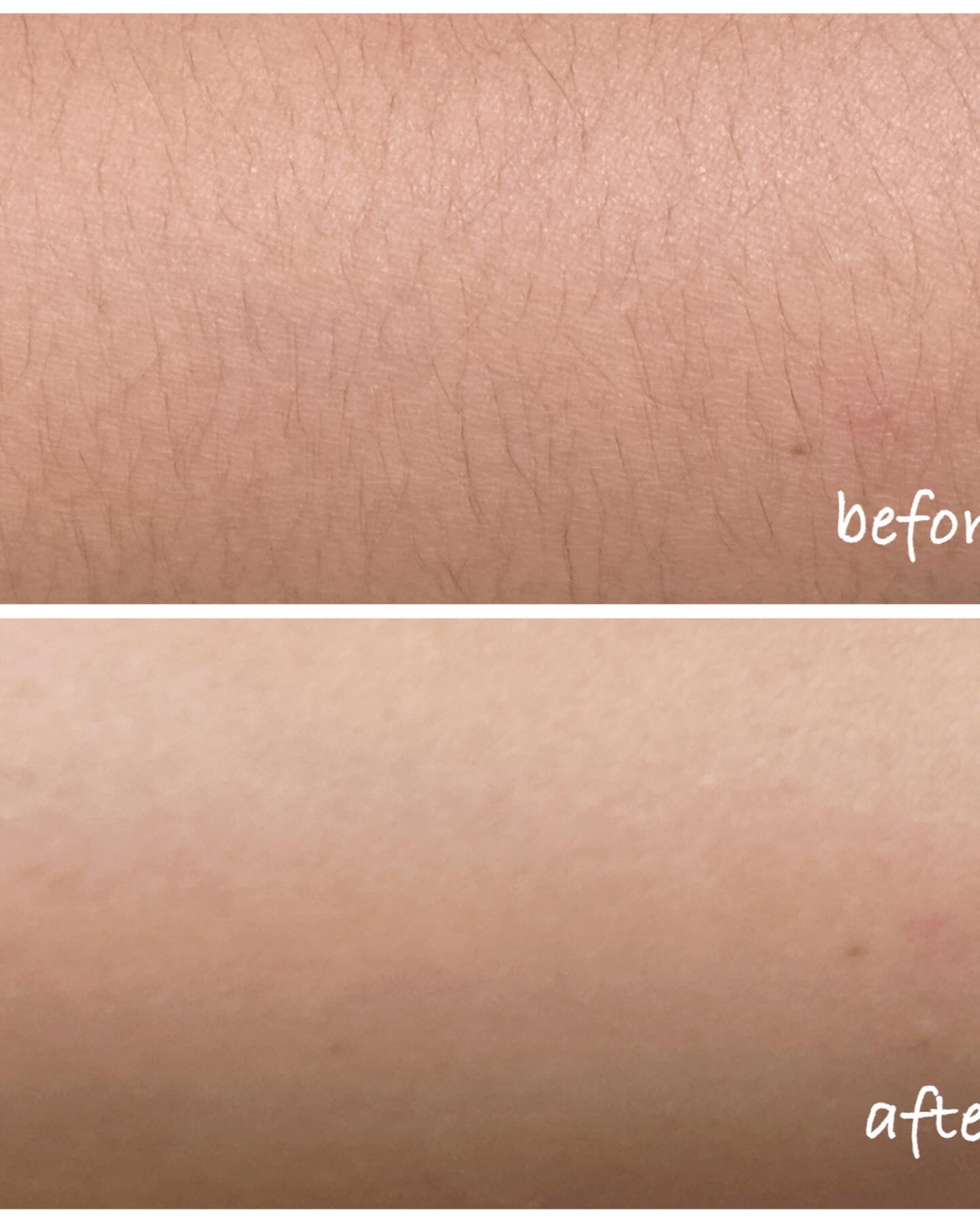 ジョモリッチ/鎌倉ライフ/除毛クリームを使ったクチコミ（2枚目）