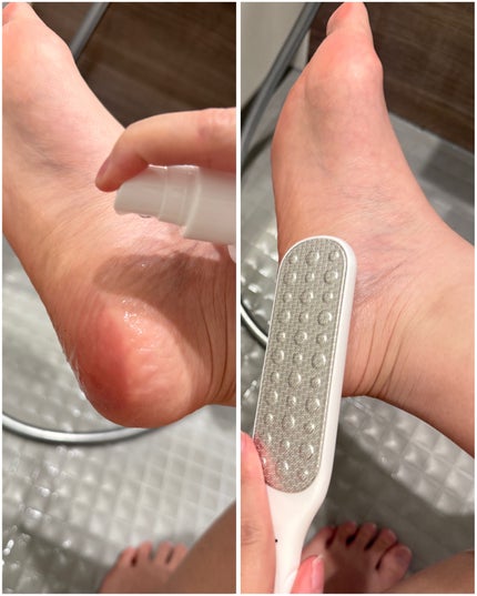 フットケアセット/BAREN/その他キットセットを使ったクチコミ(3枚目)