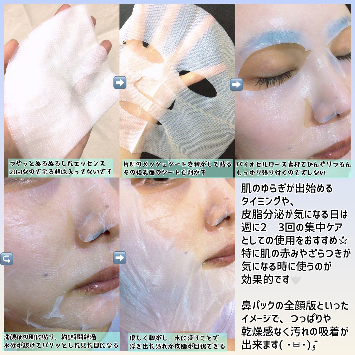 トラブルパッチマスク/EIOM/その他スキンケアを使ったクチコミ(3枚目)