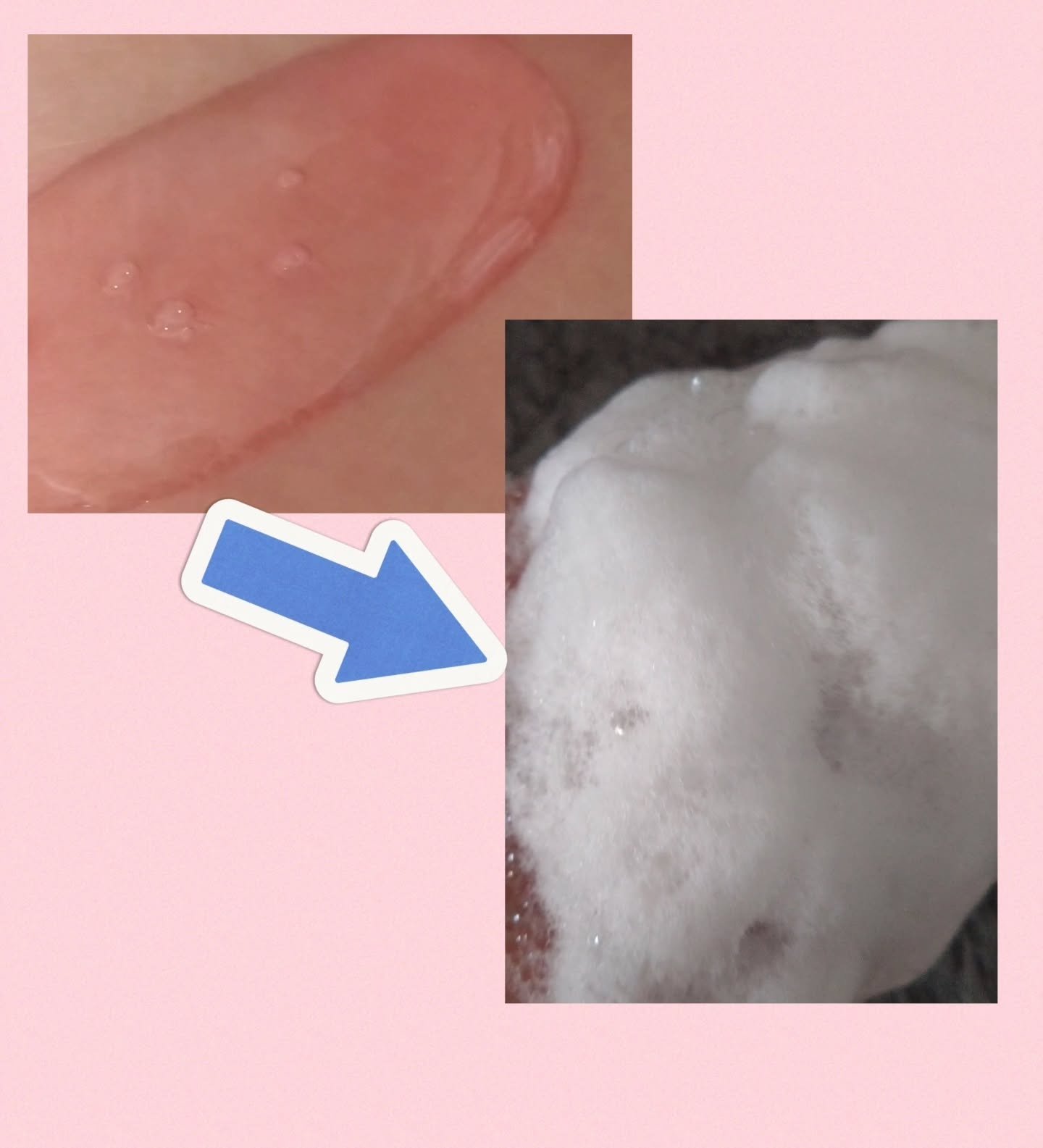 Gooseberry AHA Jelly Cleanser/By Juccy/クレンジングジェルを使ったクチコミ（3枚目）