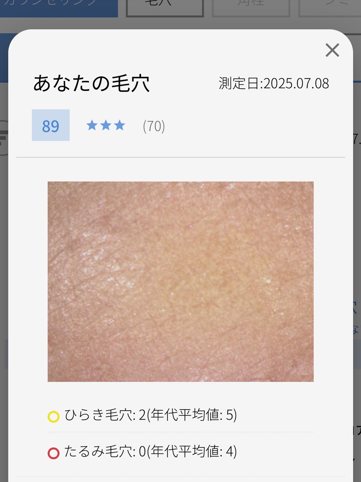 プレミアムカロリミット/ファンケル/ボディサプリメントを使ったクチコミ（3枚目）