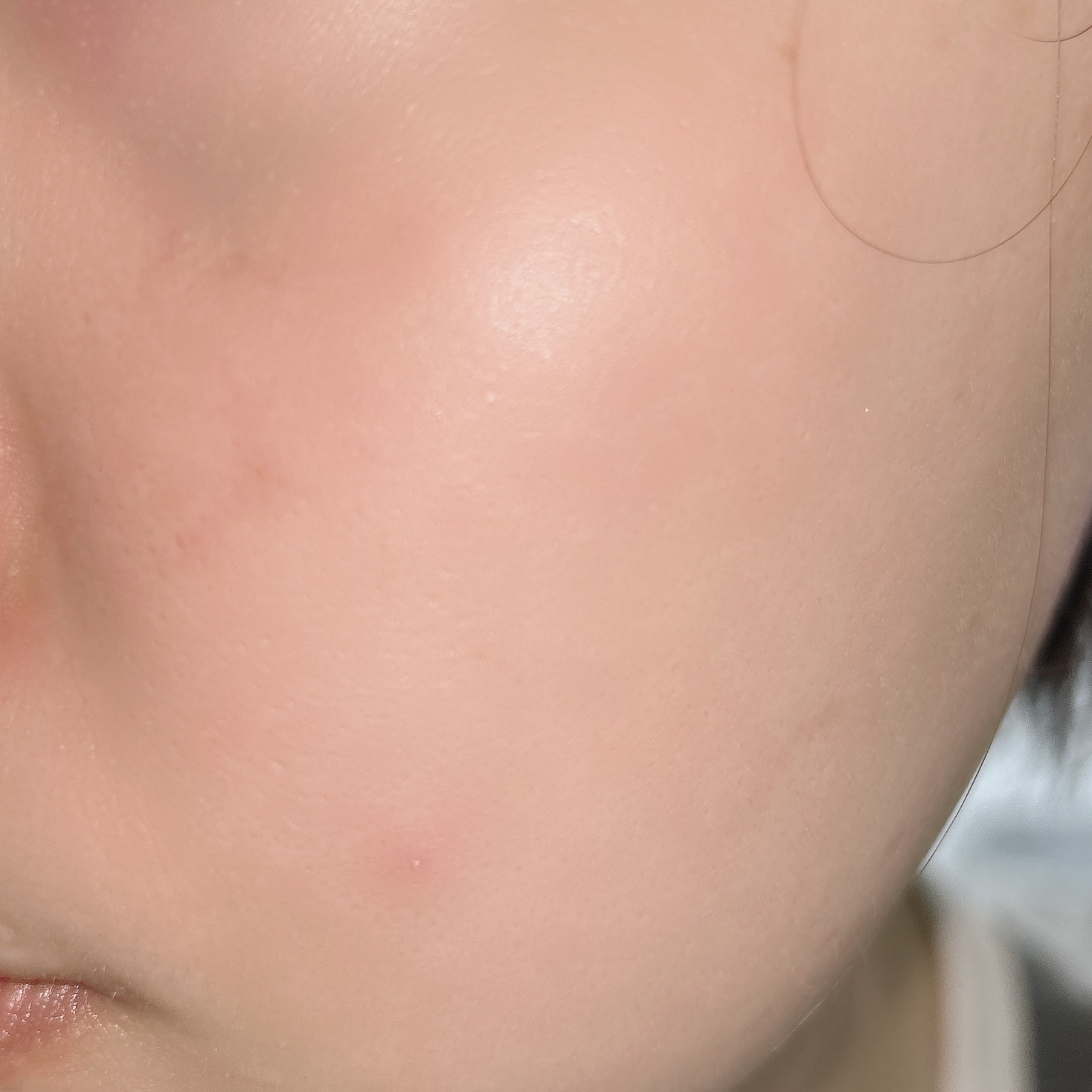 アゼライン酸誘導体※/TUNEMAKERS/美容液を使ったクチコミ（3枚目）