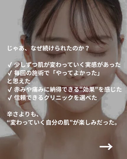 美容ニキ@美容ラボ on LIPS 「#ダーマペン#美容医療 ..」(6枚目)