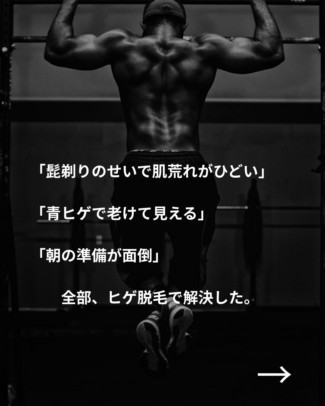 美容ニキ@美容ラボ on LIPS 「#ヒゲ脱毛#医療脱毛#脱毛..」(2枚目)