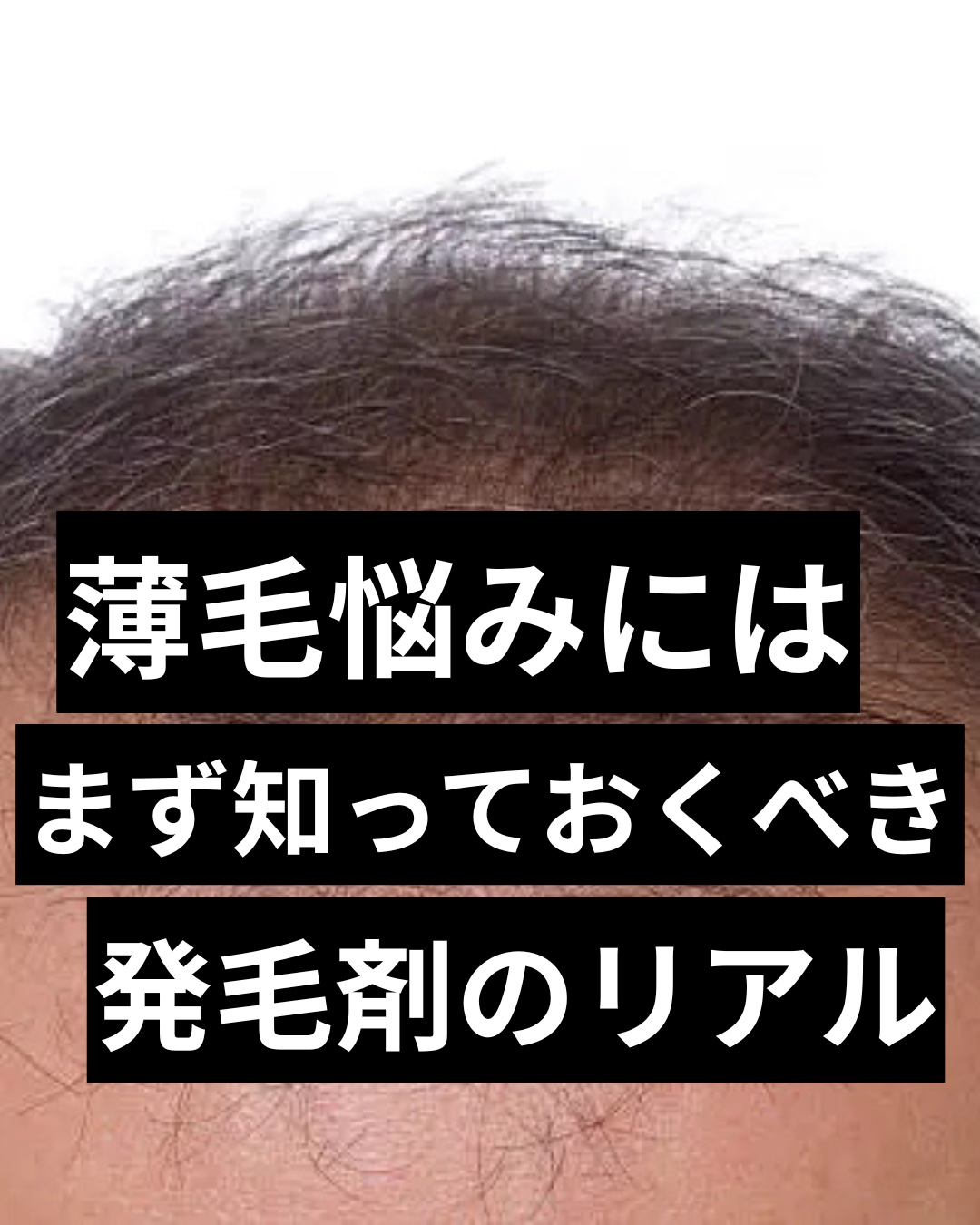 #発毛剤 #育毛剤 #ヘアケア　