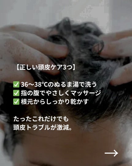 美容ニキ@美容ラボ on LIPS 「#頭皮ケア..」(4枚目)